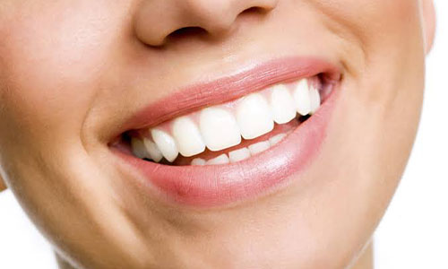 Cosmetic dentistry